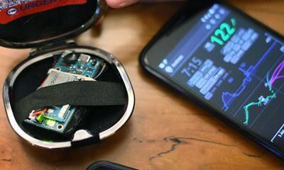 美敦力研发出了DIY人工胰腺