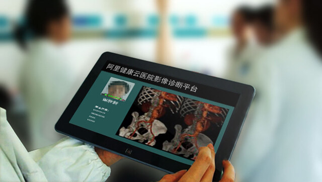 虐shi单身狗，又一对CP——Misfit & 游泳制造商Speedo牵手成功