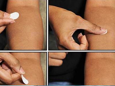 贴片式微针疫苗 无痛还能自己注射