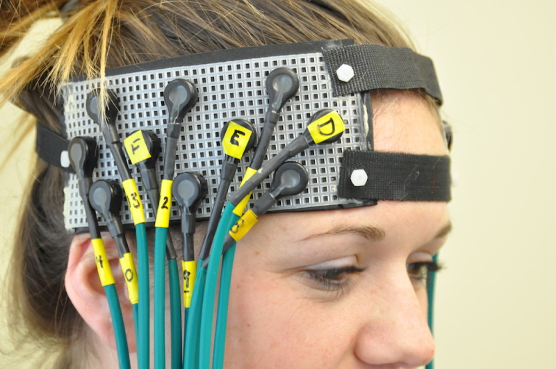 飞利浦将开发新型手持脑震荡检测仪