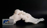 麦递途：期待实现3D打印的人体植入，大幅提升手术效率