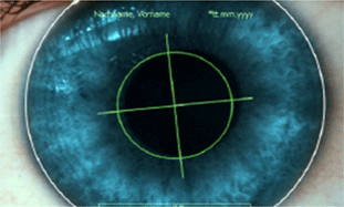 2015最值得关注的30家医疗初创公司NeuroTrack：提前3到6年预测阿尔茨海默氏症