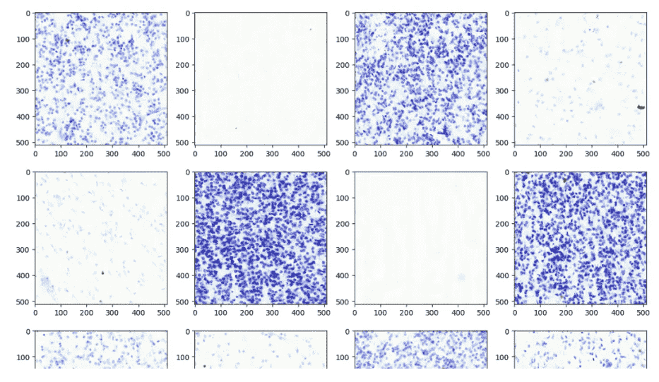 使用GPU加速的nvImageCodec推进医学影像解码