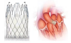 瑞士NVT股权完成交割，蓝帆医疗正式迈入结构性心脏病黄金赛道