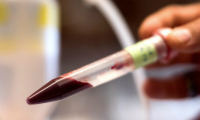 用人造血液可以替代人体血液？华盛顿大学的教授说可以！