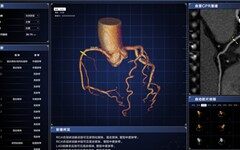商汤科技SenseCare创“心”升级，探索“联邦学习”入选ECCV