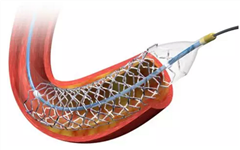 豪掷近60亿！蓝帆医疗收购心脏支架制造商柏盛国际，或成心脏支架第一股