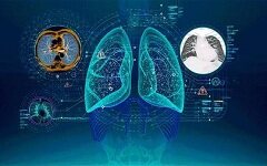 深睿医疗完成1.5亿A+轮融资，丹华资本领投