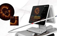 中国自主研发心血管OCT系统正式上市，助力PCI精准治疗