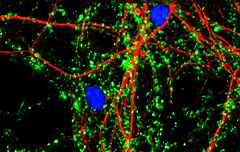 【首发】霍德生物获数千万元A+轮融资，继续推动神经性疾病细胞治疗研究
