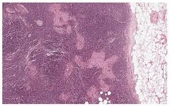 从病理图像切入，人工智能医疗公司Paige.AI完成2500万美元A轮融资