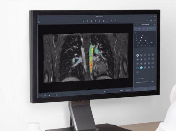  Arterys完成700万美元A轮融资 与通用医疗合作精准诊断心血管疾病