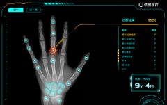 国内儿童骨龄AI产品第一证！依图医疗儿童骨龄AI产品NMPA三类证获批