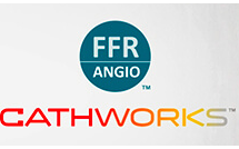 医疗设备公司CathWorks完成3000万美元C轮融资，创新冠心病治疗方式
