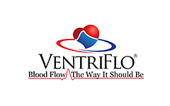 医疗设备公司VentriFlo完成1000万美元A轮融资，开发脉动式血泵系统