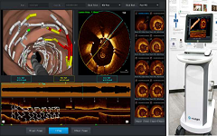 微光医疗完成1.2亿人民币融资，聚焦心血管影像诊疗器械创新