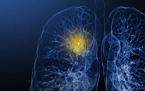 拜耳推出Calantic®数字化解决方案，影像诊断业务拓展人工智能市场