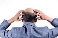 非那雄胺喷雾首度问世，为“雄脱”患者带来新生机