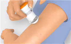 透皮给药系统全球市场将达814亿美元，这20家企业都在作何努力？