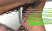 睿盟希国际眼视光基金投资以色列青光眼激光治疗器械公司BELKIN Laser 