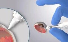 极目生物宣布3200万美元A轮融资，积极推进创新眼科疗法