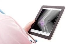 【首发】骨科AI企业长木谷完成数千万元Pre-A轮融资，联想之星领投，峰瑞资本与万辉资本跟投