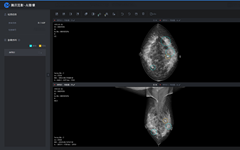 “中国式”乳腺癌高发期提前了10年，AI能否成为解决的助力？