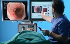 人工智能介入胃癌诊断，浙江成立胃癌等三大癌症诊治技术研究中心