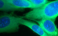 Aprea Therapeutics 完成500万欧元C+轮融资，推进新型抗癌药物APR-246的临床研究