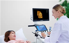 电商时代，医疗器械销售也迎来创新模式，这家公司竟然要在淘宝卖超声？